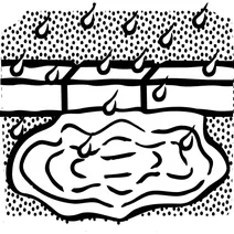 Калюжа